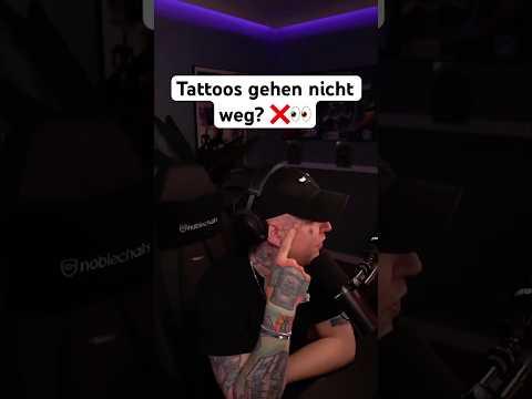 Wie läuft die Tattoo-Entfernung? 🤔