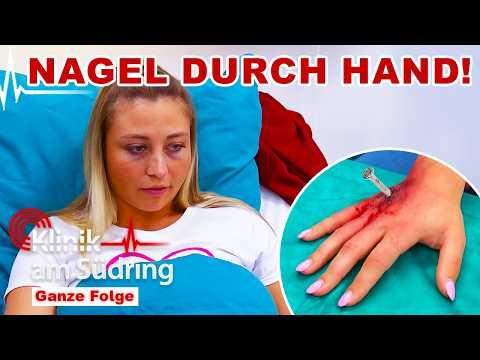 Erst Nagel-Unfall, dann Vergiftungs-Alarm: Was verheimlicht diese Frau? | Klinik am Südring | SAT.1