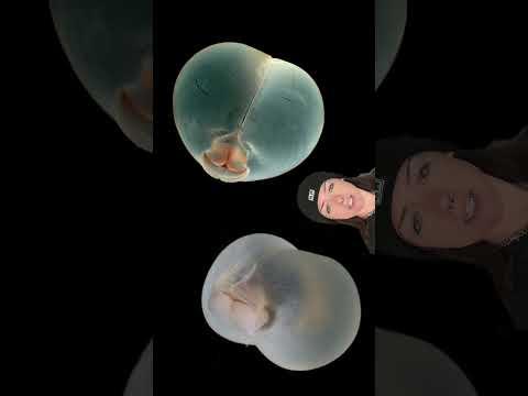 some real freakass worms