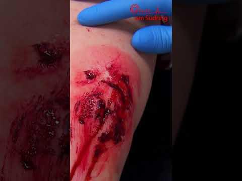 Überfallen! #krankenhaus #notaufnahme #klinikamsüdring #sat1