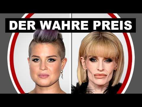 Schlaffe Gesichter & Sammelklagen: Die bittere biologische Quittung von Ozempic & co.