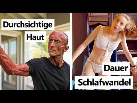 8 Menschen mit unerklärlichen Konditionen