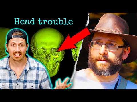 His skull was melting... and no one knew why