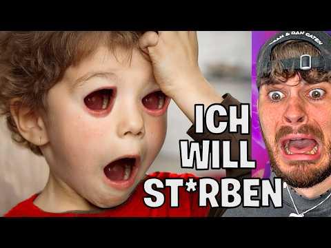 Junge wird PLÖTZLICH BLIND