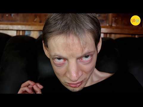 Living with "The Cat Cry" Syndrome (Cri Du Chat)