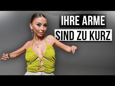 Wie ist das TAR-SYNDROM ZU HABEN?