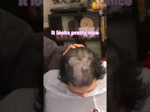 my girlfriend shaved my head