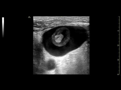 39C3 - Podcast Radiomegahertz – MHz rein | kHz raus | Ultraschall.fm mittendrin