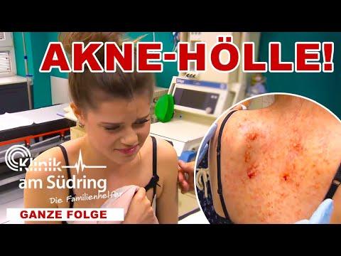 Aus Scham: 16-Jährige verätzt sich selbst den Rücken! | Die Familienhelfer