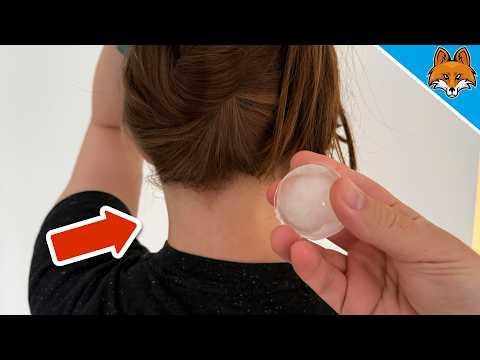 Lege einen Eiswürfel 1 Minute in deinen Nacken und STAUNE WAS PASSIERT💥(Genial)🤯
