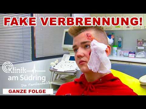 Junge täuscht Brandwunde vor! - Warum will er seinen Stiefvater testen? | Die Familienhelfer