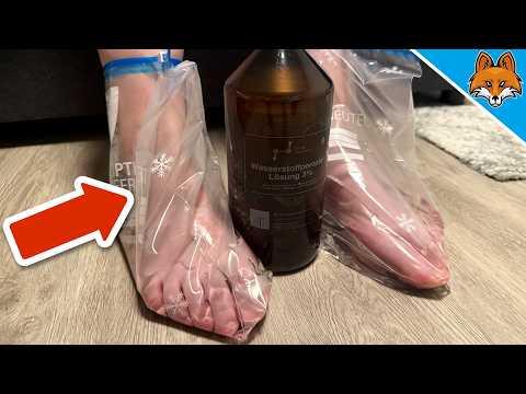 Kippe Wasserstoffperoxid auf deine Füße und STAUNE WAS PASSIERT💥(2x pro Woche)🤯