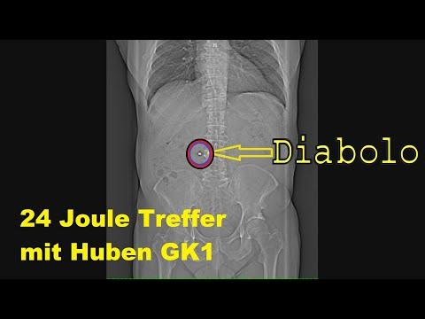 Wie gut ist Ballistikgel? Vergleich mit ECHTEM Fall.