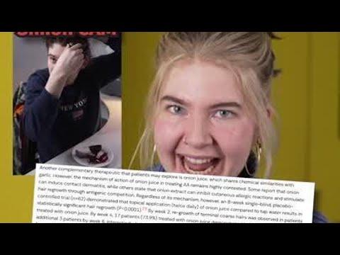 Haare vs. Zwiebel! 🧅 (Teil 2)