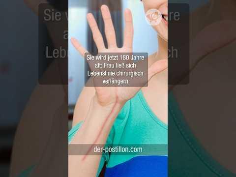 Sie wird jetzt 180 Jahre alt: Frau ließ sich Lebenslinie chirurgisch verlängern