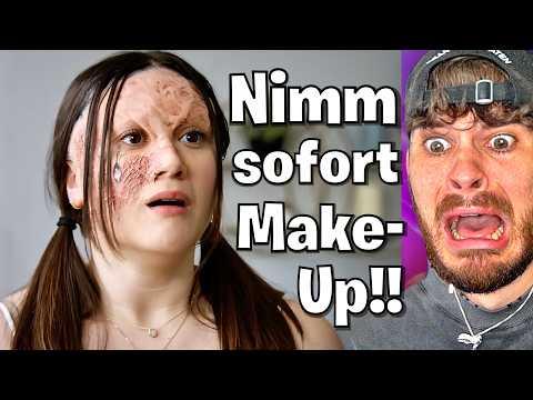 Schülerin SCHÄMT sich für ihr Gesicht
