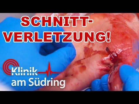 Selbstverletzung aus Angst vor Begegnung mit Partnerfamilie? | Klinik am Südring | SAT.1