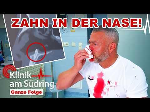 Nach Fußball-Foul: Ärzte finden ZAHN in seiner Nase! | Klinik am Südring | SAT.1