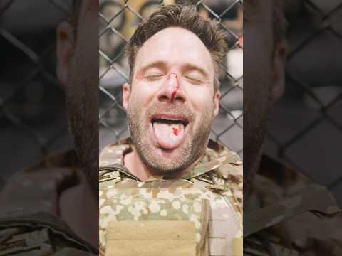 So kam es zu der blutigen Nase…