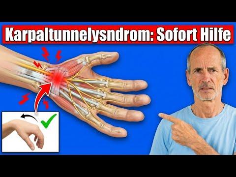 Sofort HILFE bei Karpaltunnelsyndrom (unter 10 Min)