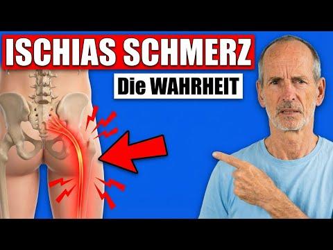 Niemand sagt dir DAS über ISCHIAS Schmerzen