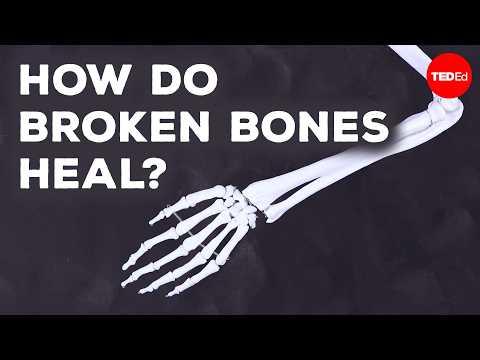 What happens when you break a bone? - Gurpreet Baht and Natalie Pang