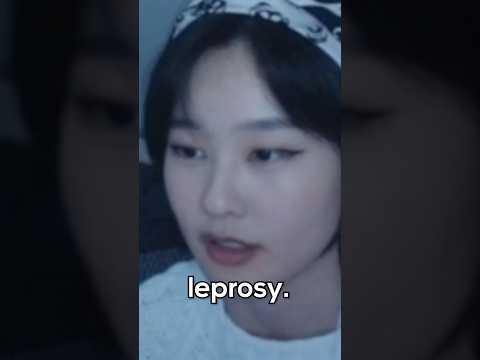 she has leprosy :(