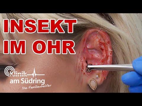 Biss/Riss im Trommelfell: Woher kommt das Insekt in Laras Ohr? | Die Familienhelfer