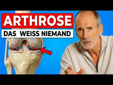 Die Wahrheit über ARTHROSE (Was DIR niemand sagt)