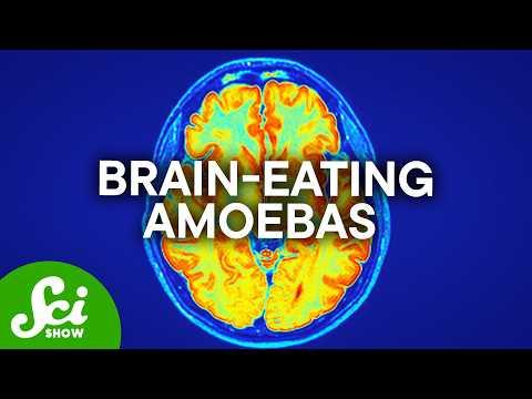 How Worried Do You Need To Be About Brain Eating Amoebas