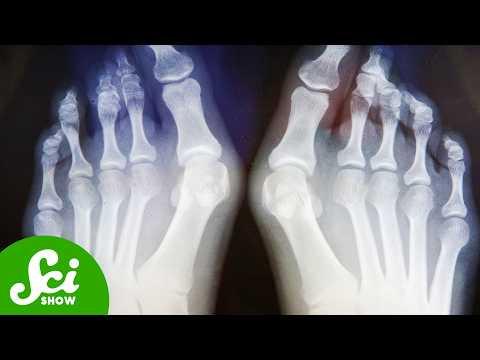 We Still Don’t Know Why We Walk on Two Legs