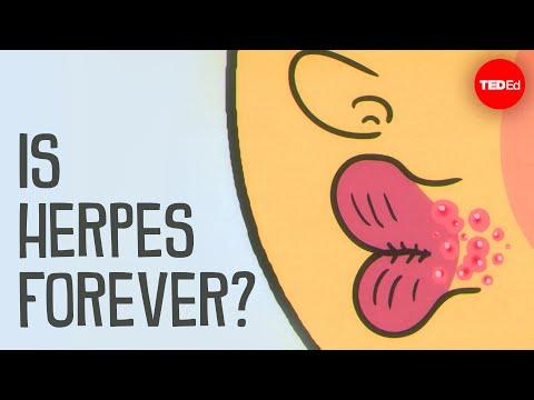 What causes herpes, and how can you treat it? - Christine Johnston