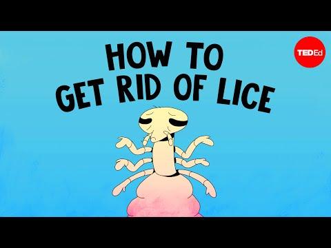 This is the most common way to get head lice - Nazzy Pakpour