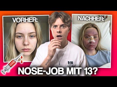 Schönheits-OPs bei Teenagern - Warum sich immer mehr Jungendliche operieren lassen...