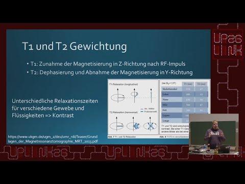Uplink 2026 - Magnetresonanztomographie wie funktioniert das?