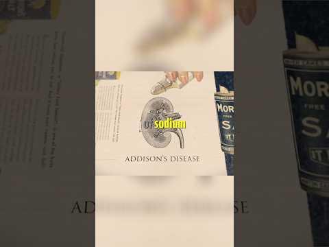 Doctors took a kid’s salt away. He died