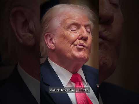 Trump Appears To Doze During Stroke