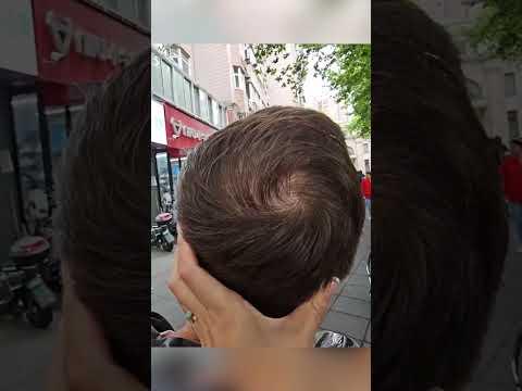 It's Not That Bad Right 😅