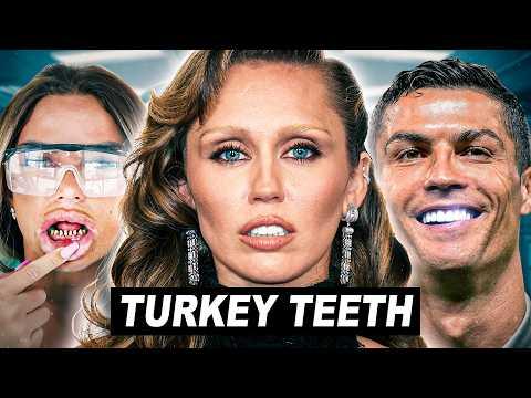 🚨 Mein neues Video zu "Turkey Teeth" wurde zu Unrecht von einer Influencerin gesperrt. Dadurch war das Video jetzt mehrere Stunden offline und das dann auch den Algorithmus komplett gekillt. 

Aber: Es ist jetzt wieder da. Mit Hilfe von einem Anwalt und den damit verbundenen Kosten, die dadurch entstanden sind.. Jetzt brauche ich, um das Video noch zu retten, eure Unterstützung 🥺!

In dem Video steckt super viel Arbeit und die einzige Möglichkeit den Algorithmus noch zu retten und Aufmerksamkeit auf