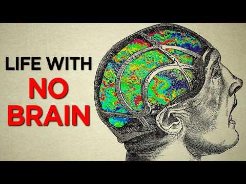 What happens when your world is an unsolvable puzzle? When you can write but can't read it? The story of Lev Zasetsky changed everything about how we understand brains. It's a crucial piece of our own human puzzle. Enjoy this new video! -Kevin