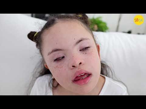 A Blind Child with Down Syndrome Who Loves Making Friends