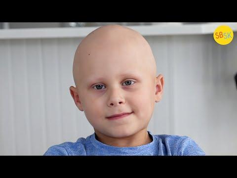 A Kid with Alopecia Learning to Love Himself